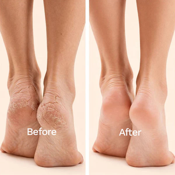Foot Peel Mask