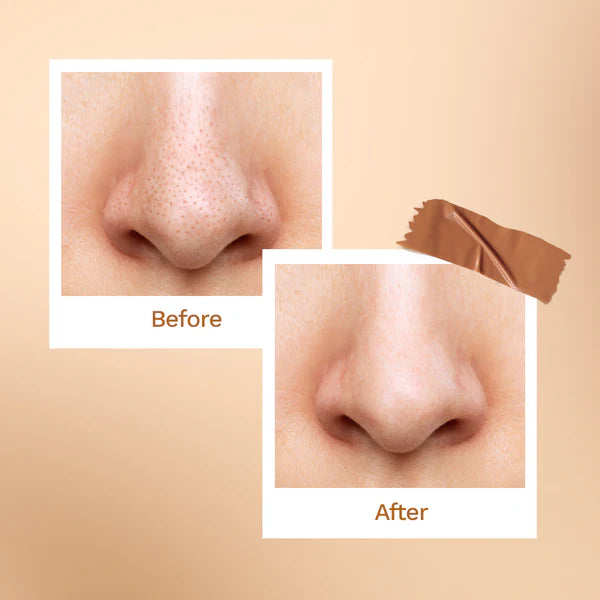 Bamboo Charcoal Nose Strips (3N)