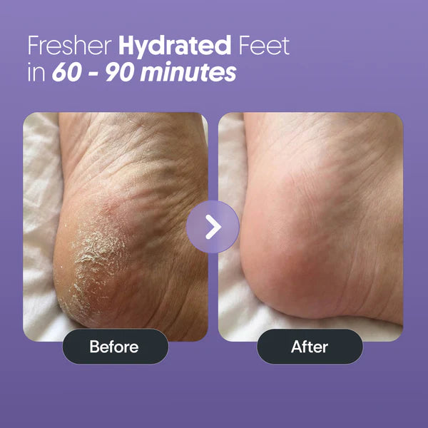 Foot Peel Mask