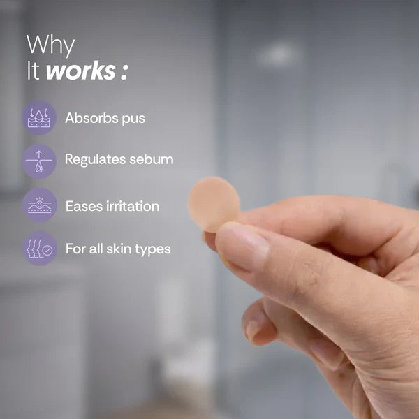 Acne Relief Patches (30 Patches)