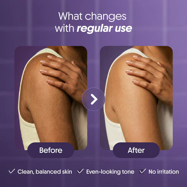 Kojic Acid Soap