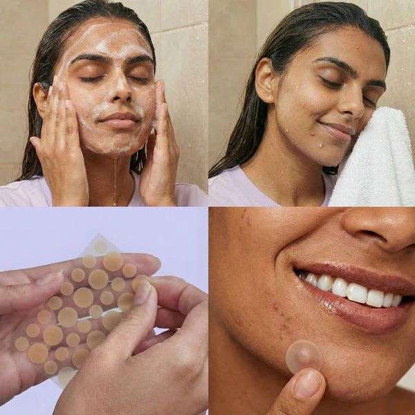 Acne Relief Patches (60 Patches)