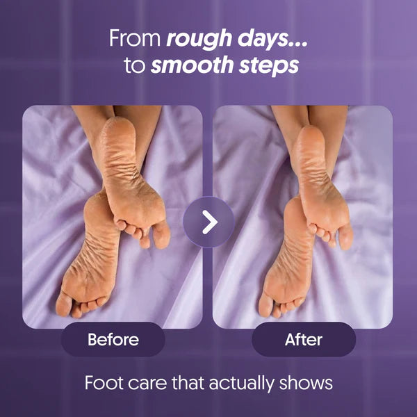 Urea & Natural AHAs Foot Cream